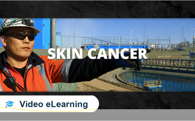 Skin-Cancer